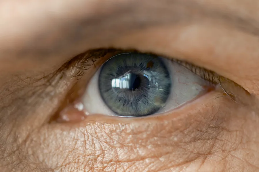 A close-up of an eye